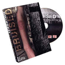 Bruised by Daniel Martin